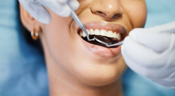 Best Broken or Chipped Tooth Repair in Reidsville, NC